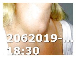How Does Viagra Work After Ejackulation Male Anatomy