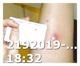 Viagra 31 Year Old