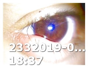 Viagra Doses 100 Mg