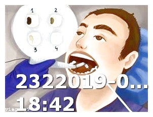 How Long Viagra Take Effect
