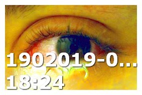Viagra and Alcohol Interaction With Amoxicillin
