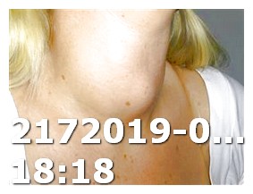 Viagra Femenina Quien No Las Puede Tomar Amoxicilina