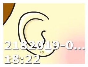 Generic Viagra Pill Size