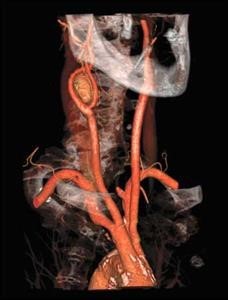 Viagra Quizlet Anatomy Bones